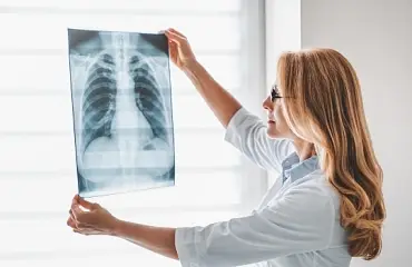 Povinné rentgeny plic u zaměstnanců ze zahraničí